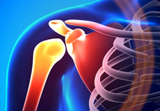 Shoulder Disorders